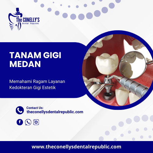 tanam gigi medan