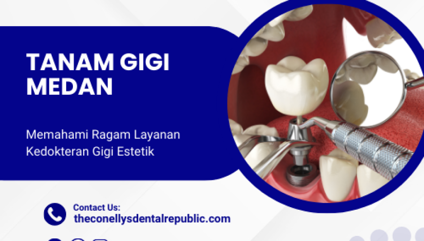 tanam gigi medan